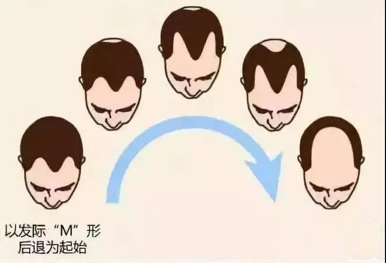 1636525760984190.jpg 脱发2_副本.jpg