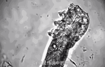 1636598658518299.gif 螨虫.gif